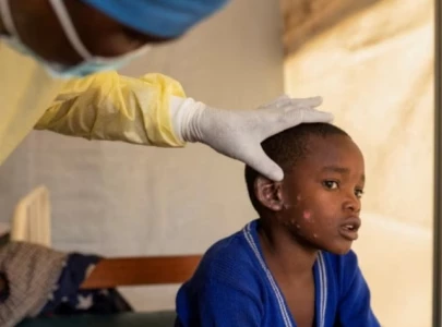 why mpox is declared an emergency again concerns over the global health emergency why mpox is declared an emergency again concerns over the global health emergency